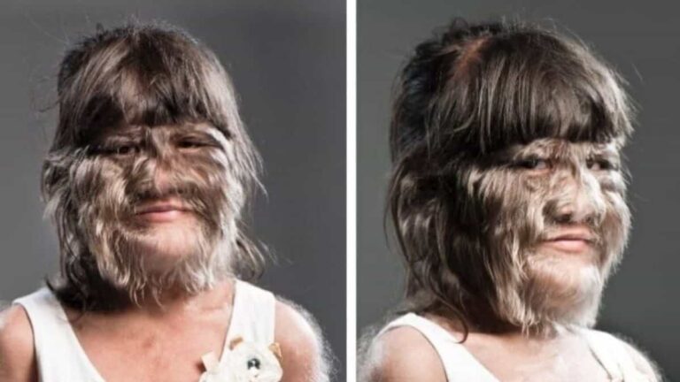 De vrouw met het meeste haar ter wereld ziet er nu zo uit